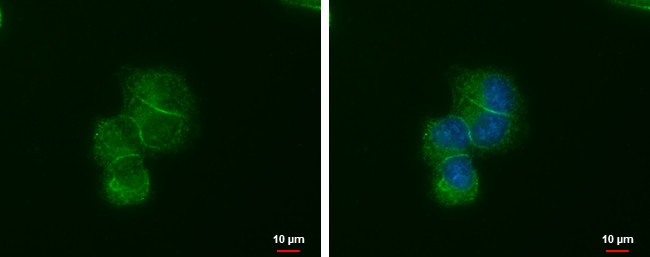 LIN7A Antibody in Immunocytochemistry (ICC/IF)