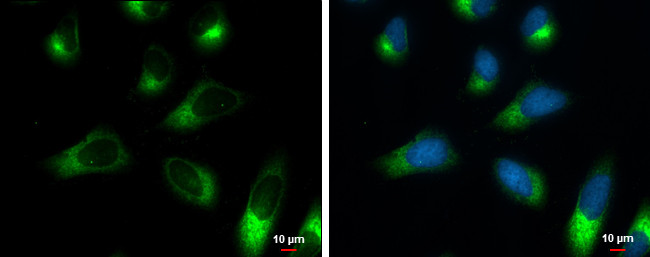 RRBP1 Antibody in Immunocytochemistry (ICC/IF)