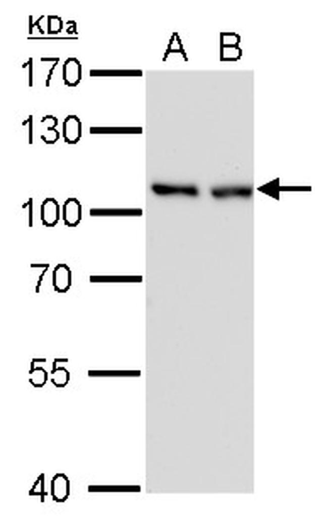 CAS Antibody in Western Blot (WB)