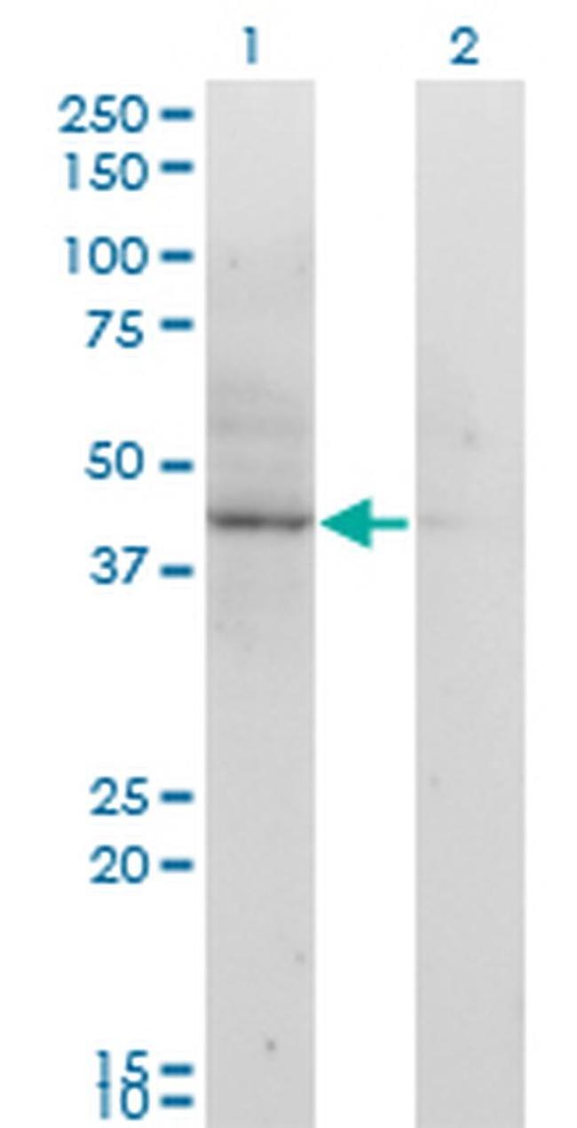 ACAT2 Antibody in Western Blot (WB)