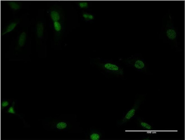 CDX4 Antibody in Immunocytochemistry (ICC/IF)