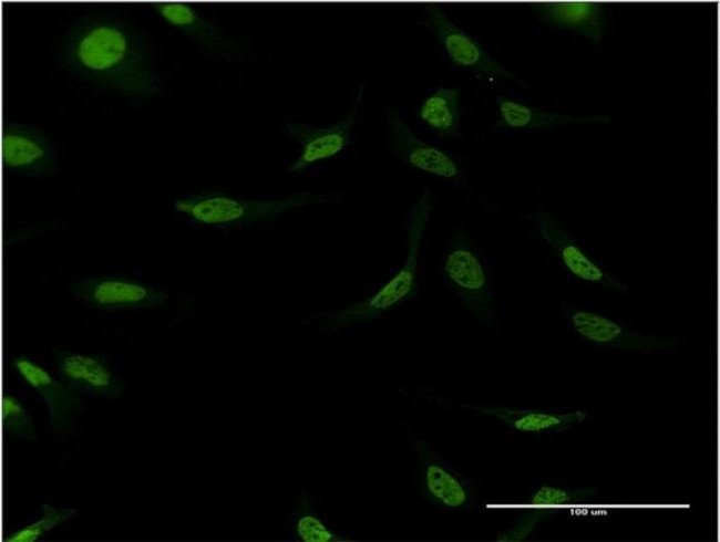 CSTF2 Antibody in Immunocytochemistry (ICC/IF)