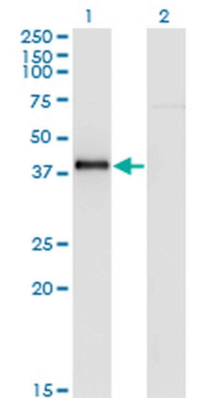 Nkx2.5 Antibody in Western Blot (WB)