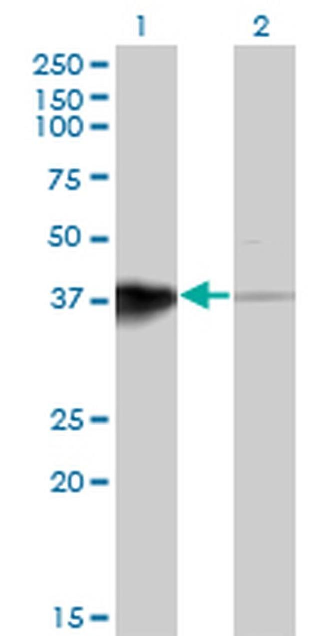 HOXB5 Antibody in Western Blot (WB)