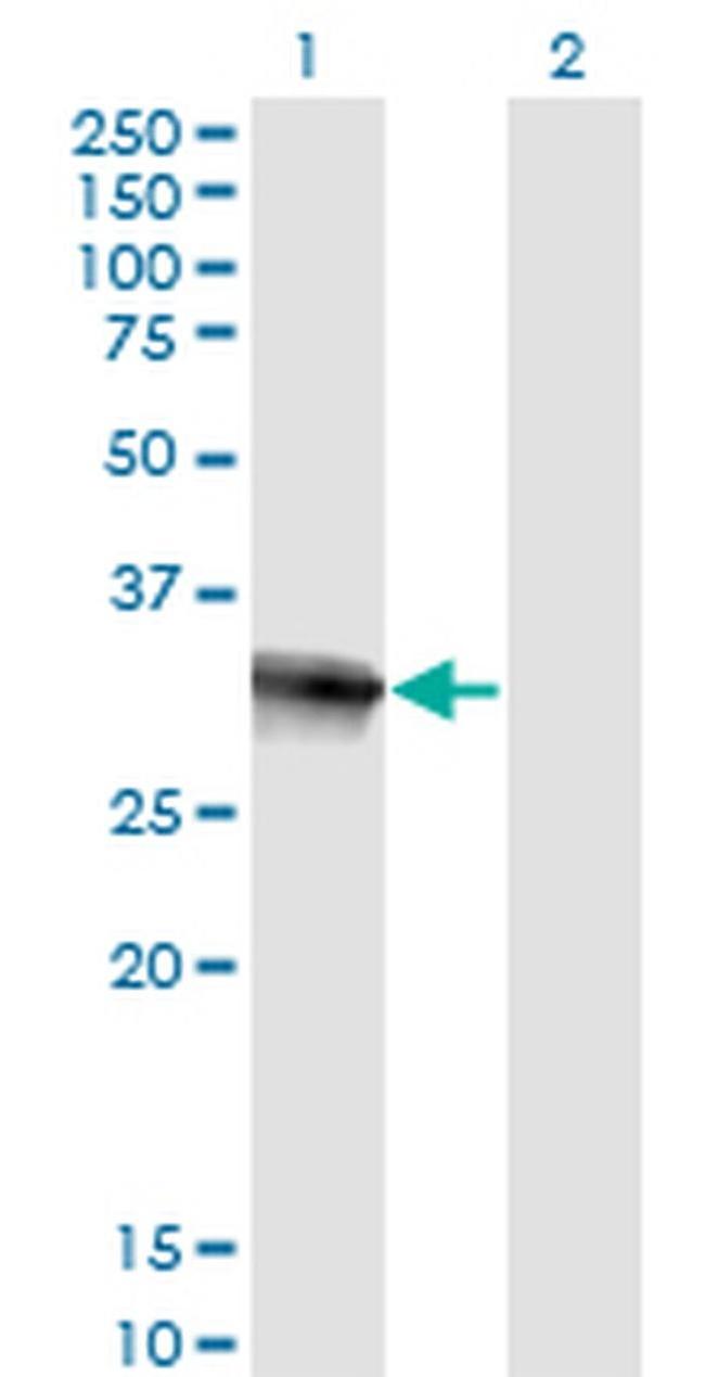 HOXB9 Antibody in Western Blot (WB)