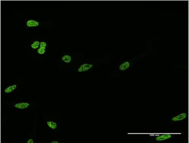HOXC12 Antibody in Immunocytochemistry (ICC/IF)
