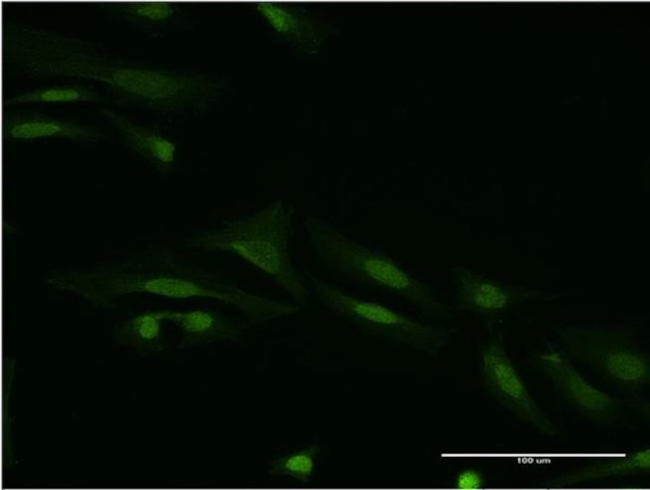 SMAD9 Antibody in Immunocytochemistry (ICC/IF)
