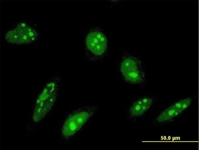 ORC4 Antibody in Immunocytochemistry (ICC/IF)