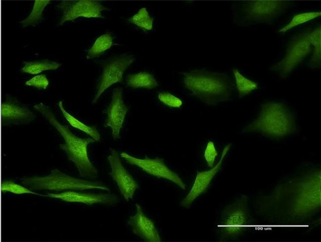 PURA Antibody in Immunocytochemistry (ICC/IF)