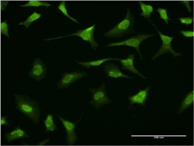RING1 Antibody in Immunocytochemistry (ICC/IF)