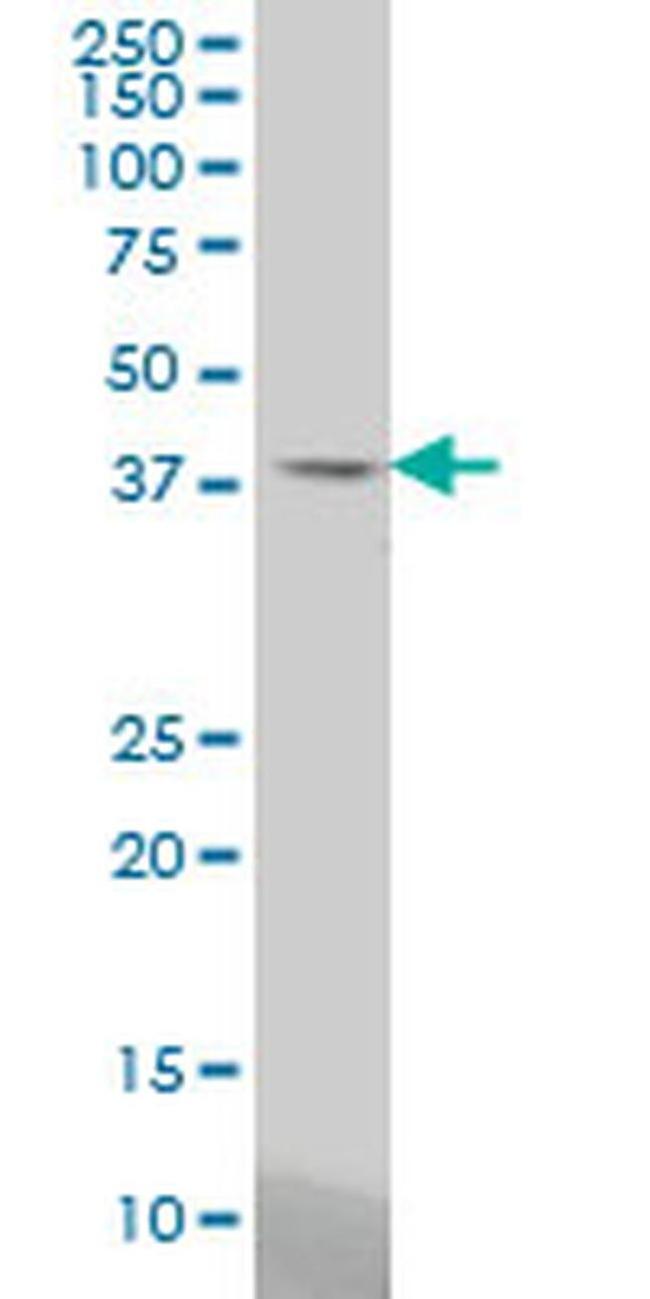STAC Antibody in Western Blot (WB)