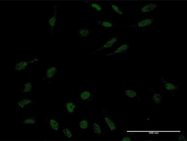 KLF10 Antibody in Immunocytochemistry (ICC/IF)