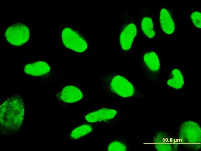 TSPYL1 Antibody in Immunocytochemistry (ICC/IF)