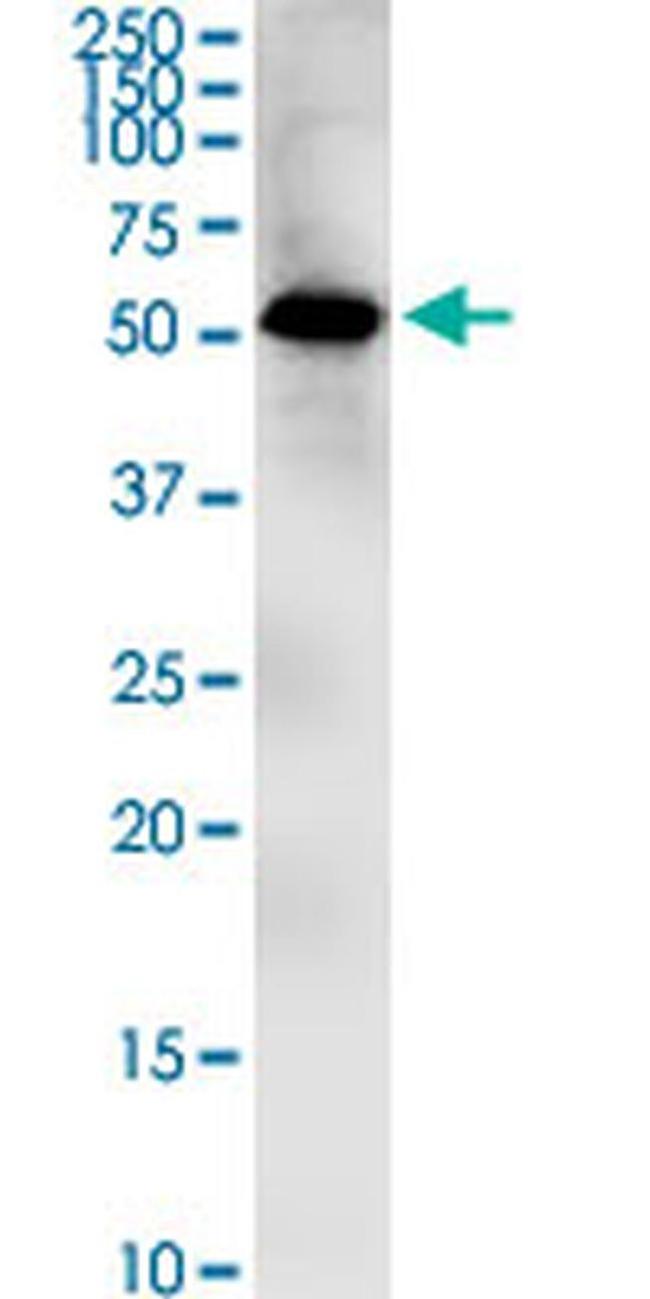 ZIC1 Antibody in Western Blot (WB)