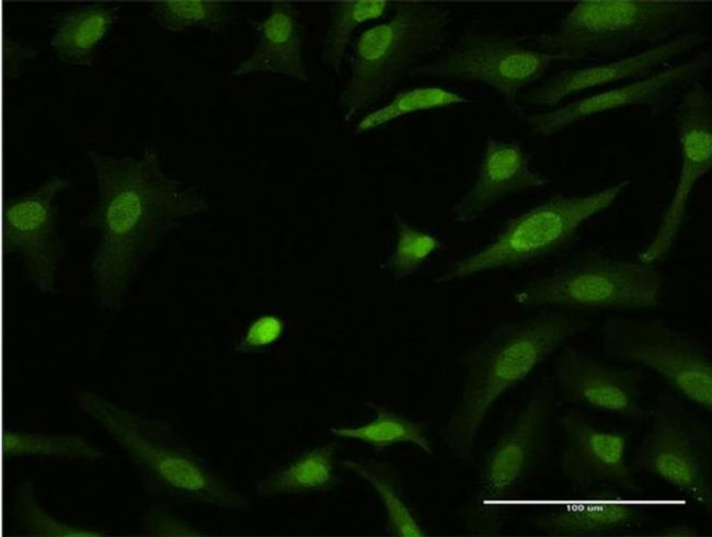 ZIC3 Antibody in Immunocytochemistry (ICC/IF)