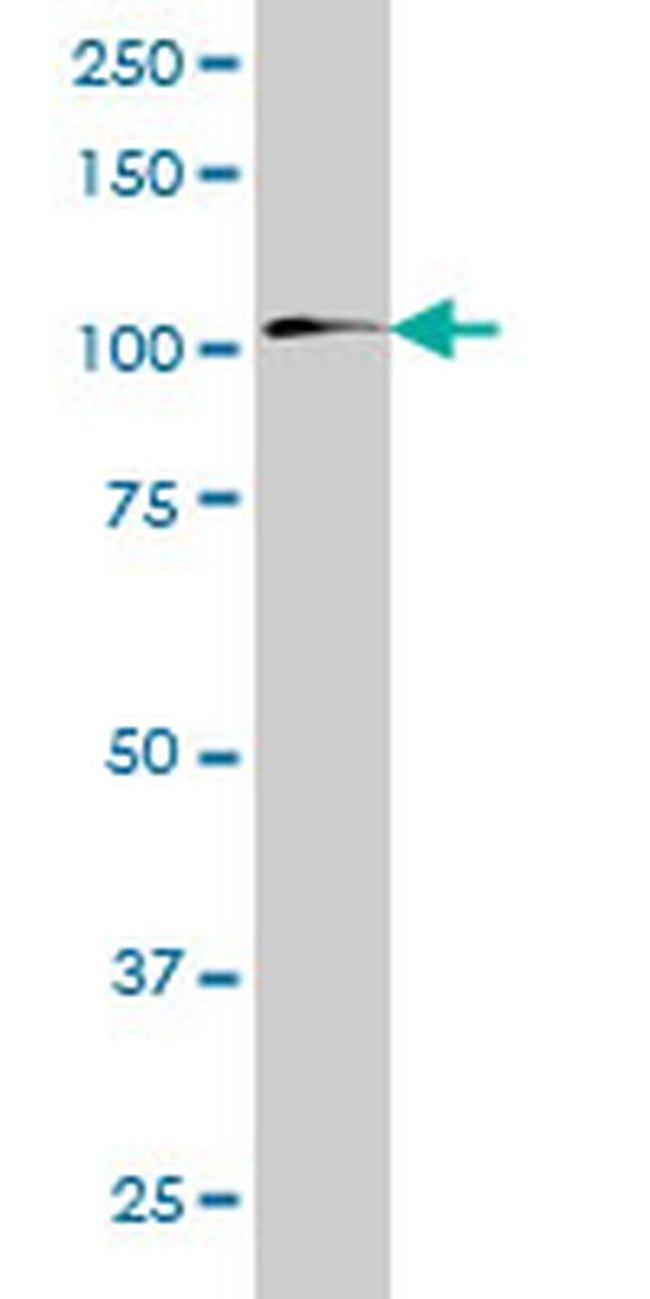 ZNF31 Antibody in Western Blot (WB)