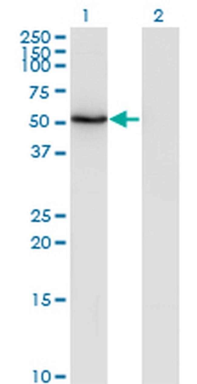 ZNF38 Antibody in Western Blot (WB)