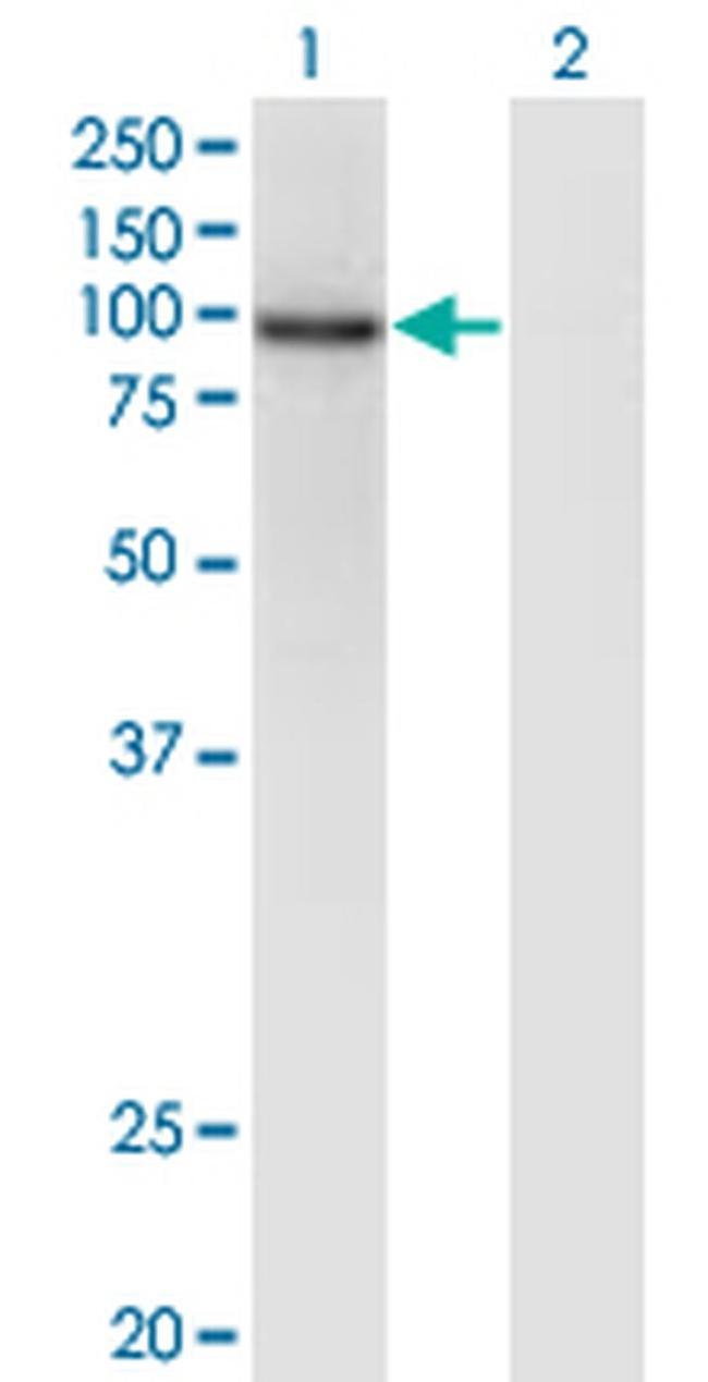 ZNF41 Antibody in Western Blot (WB)