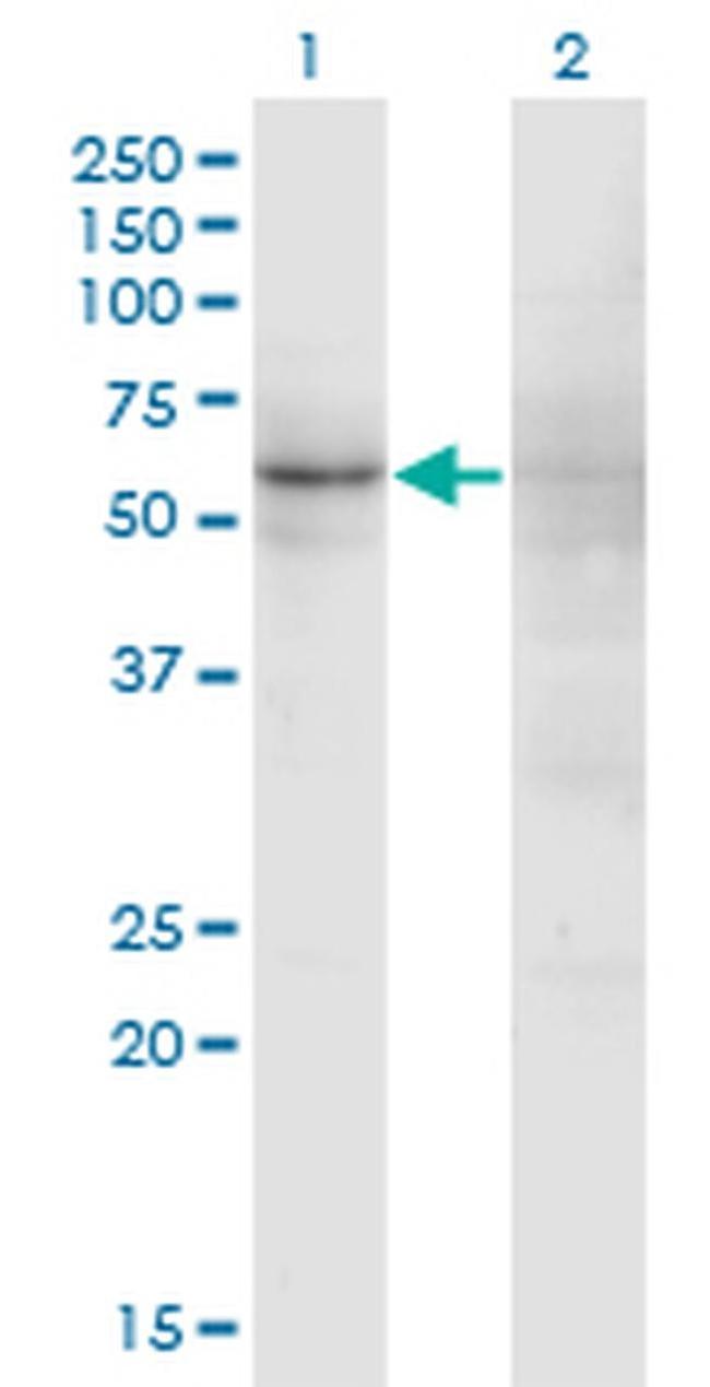 ZNF180 Antibody in Western Blot (WB)
