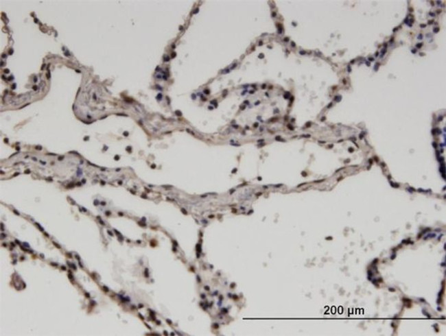 ZNF192 Antibody in Immunohistochemistry (PFA fixed) (IHC (PFA))