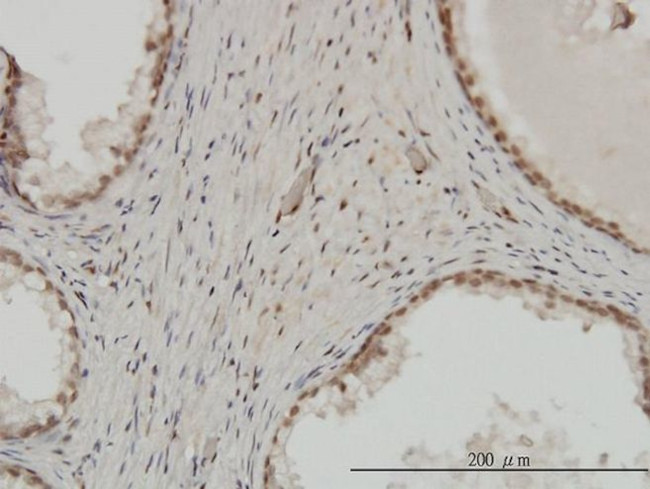 ZNF202 Antibody in Immunohistochemistry (PFA fixed) (IHC (PFA))