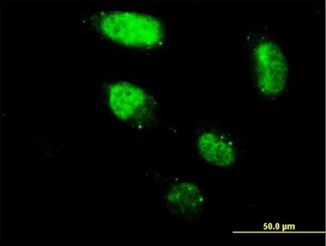 ZNF213 Antibody in Immunocytochemistry (ICC/IF)