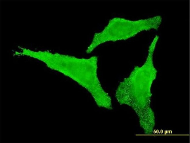 CDKL2 Antibody in Immunocytochemistry (ICC/IF)