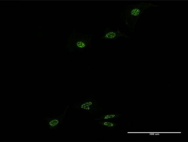 NR1D1 Antibody in Immunocytochemistry (ICC/IF)