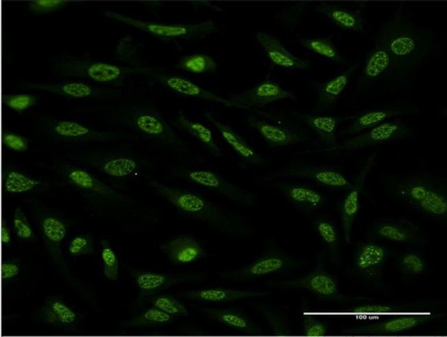 OXSR1 Antibody in Immunocytochemistry (ICC/IF)
