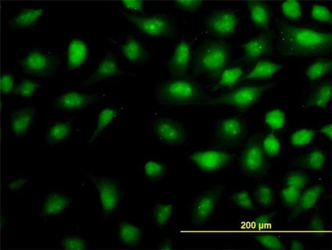 THRAP5 Antibody in Immunocytochemistry (ICC/IF)