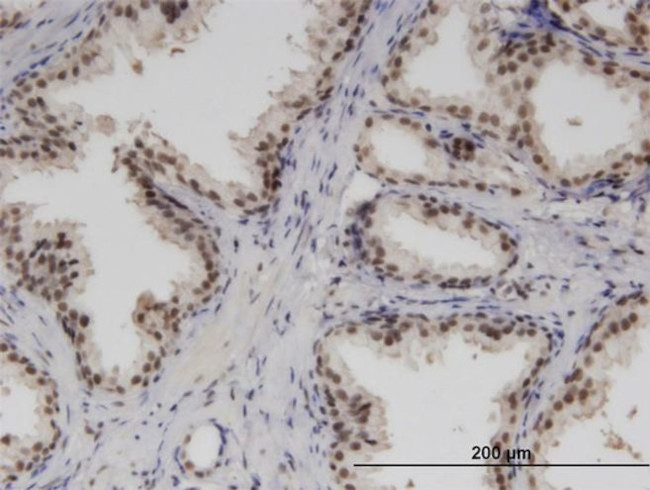 RBM6 Antibody in Immunohistochemistry (PFA fixed) (IHC (PFA))