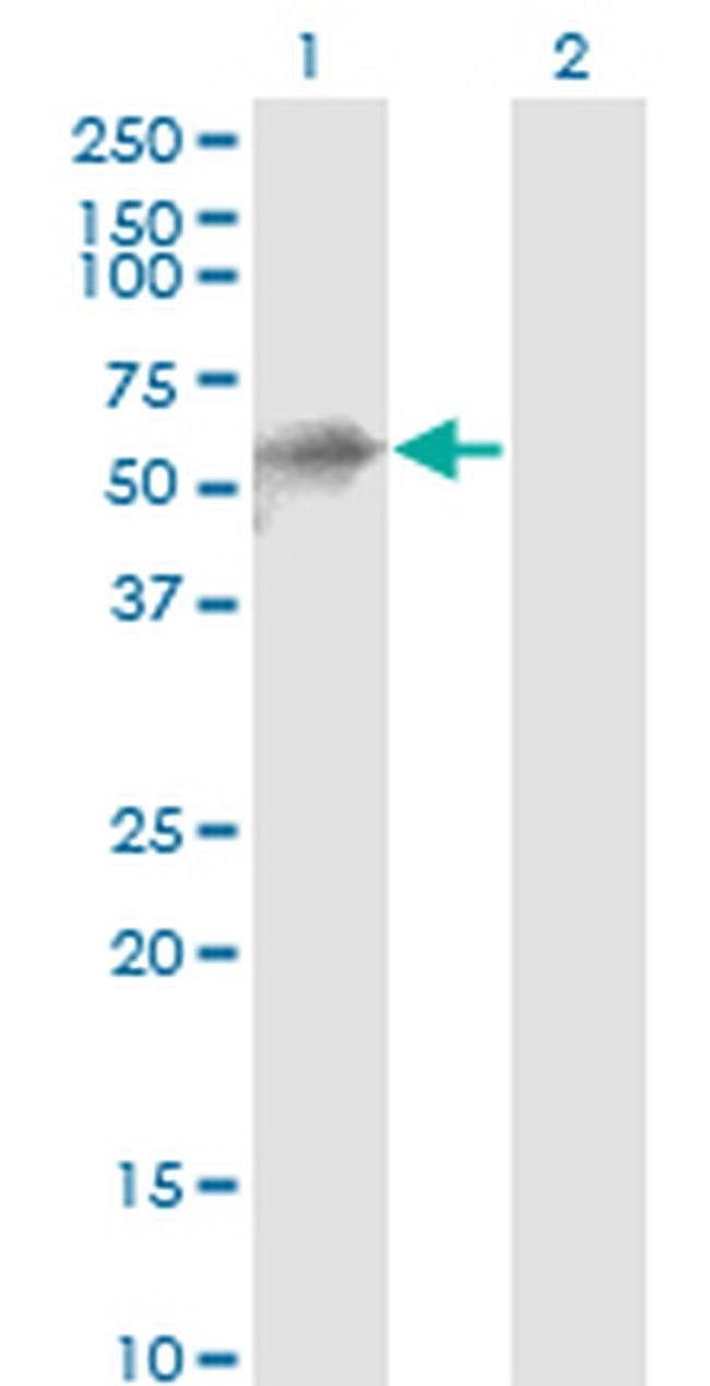 KLHL41 Antibody in Western Blot (WB)