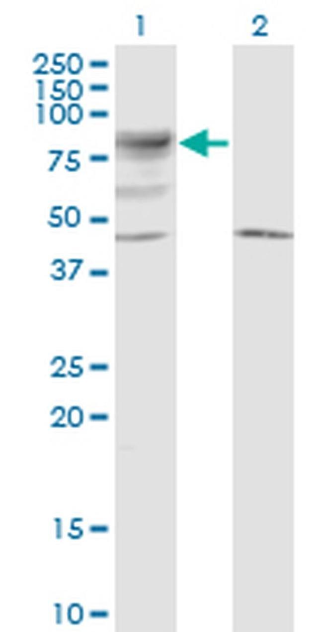 LRRN2 Antibody in Western Blot (WB)