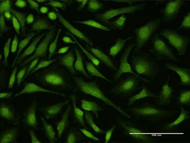 DEAF1 Antibody in Immunocytochemistry (ICC/IF)