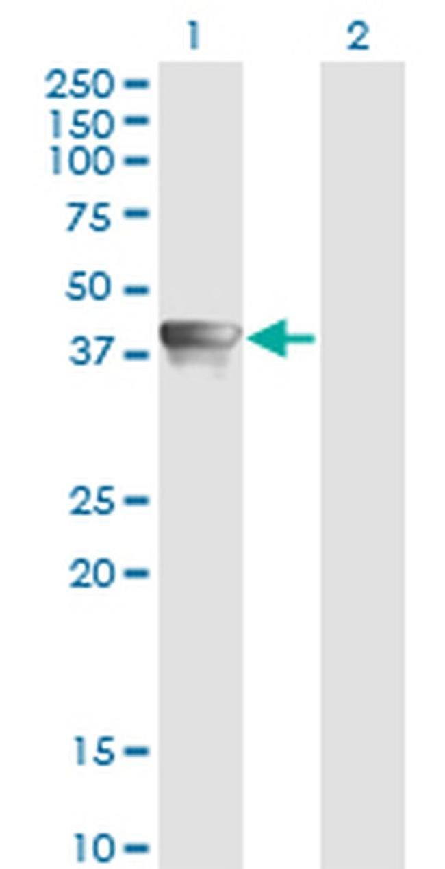AHA1 Antibody in Western Blot (WB)