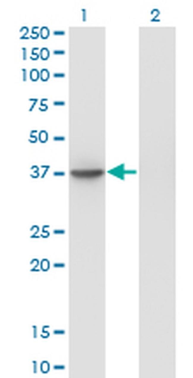 SUGT1 Antibody in Western Blot (WB)