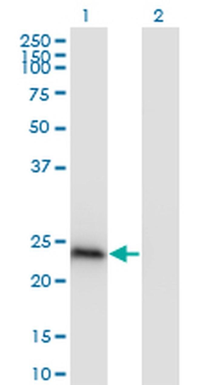 HP1 beta Antibody in Western Blot (WB)