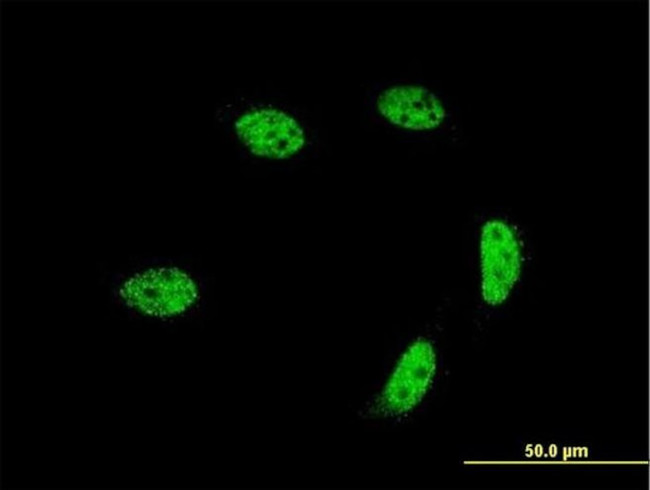 GTF2A1L Antibody in Immunocytochemistry (ICC/IF)