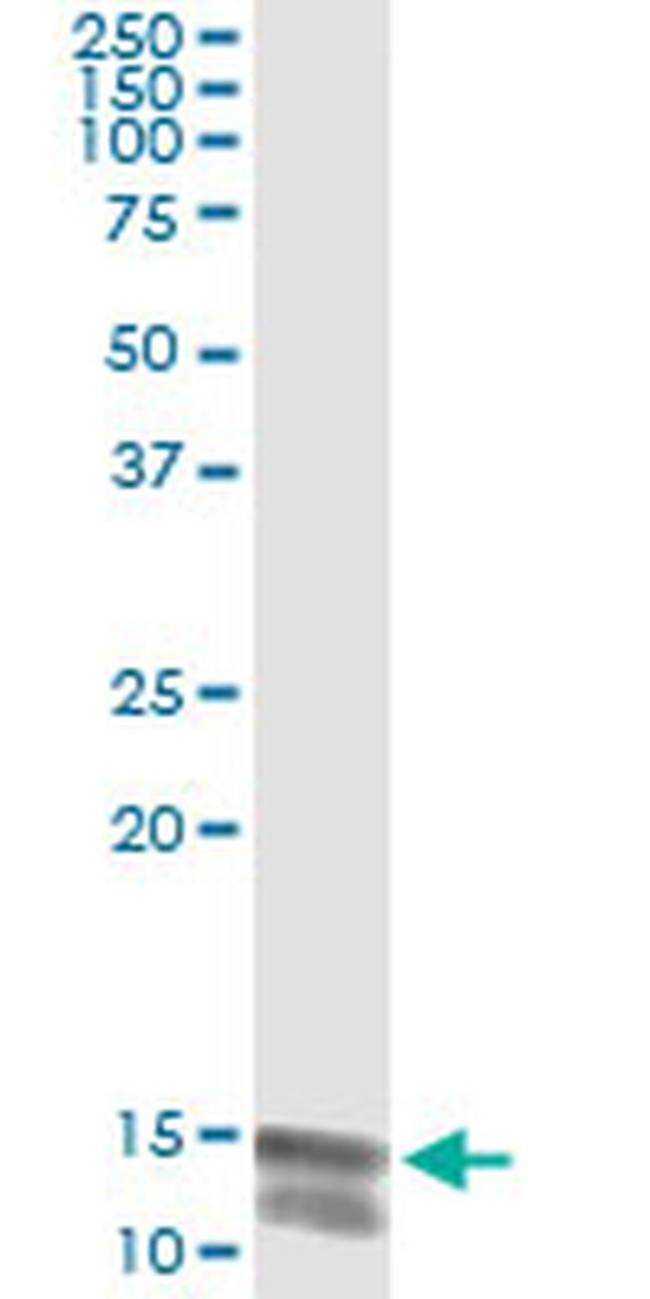 NLGN4Y Antibody in Immunoprecipitation (IP)