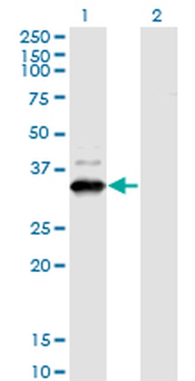 ZNF365 Antibody in Western Blot (WB)