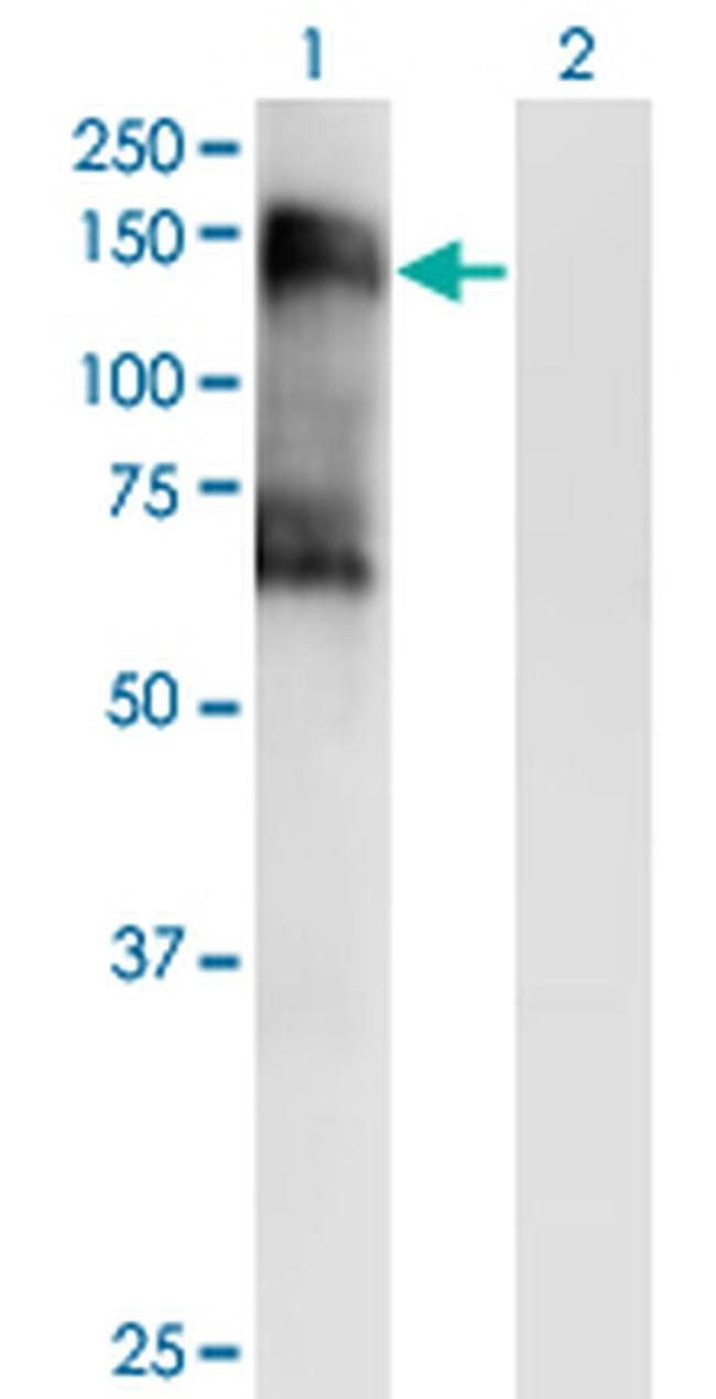 SIK2 Antibody in Western Blot (WB)