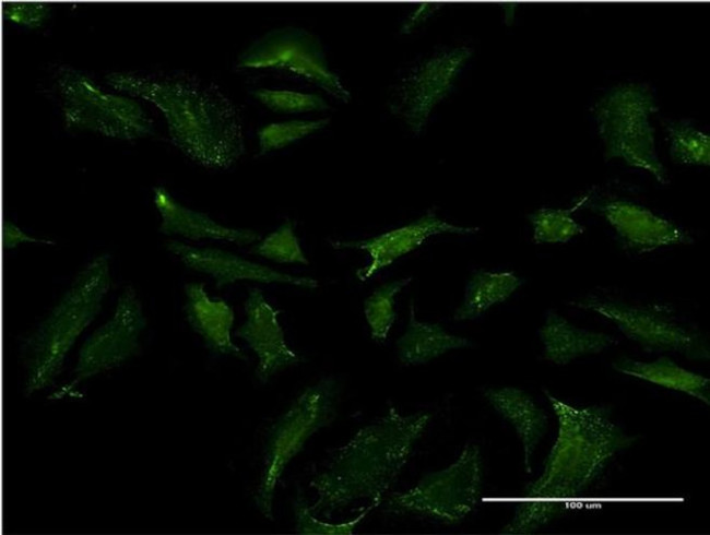 ABCB9 Antibody in Immunocytochemistry (ICC/IF)