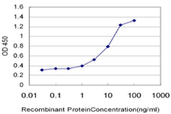 TRPC4AP Antibody in ELISA (ELISA)