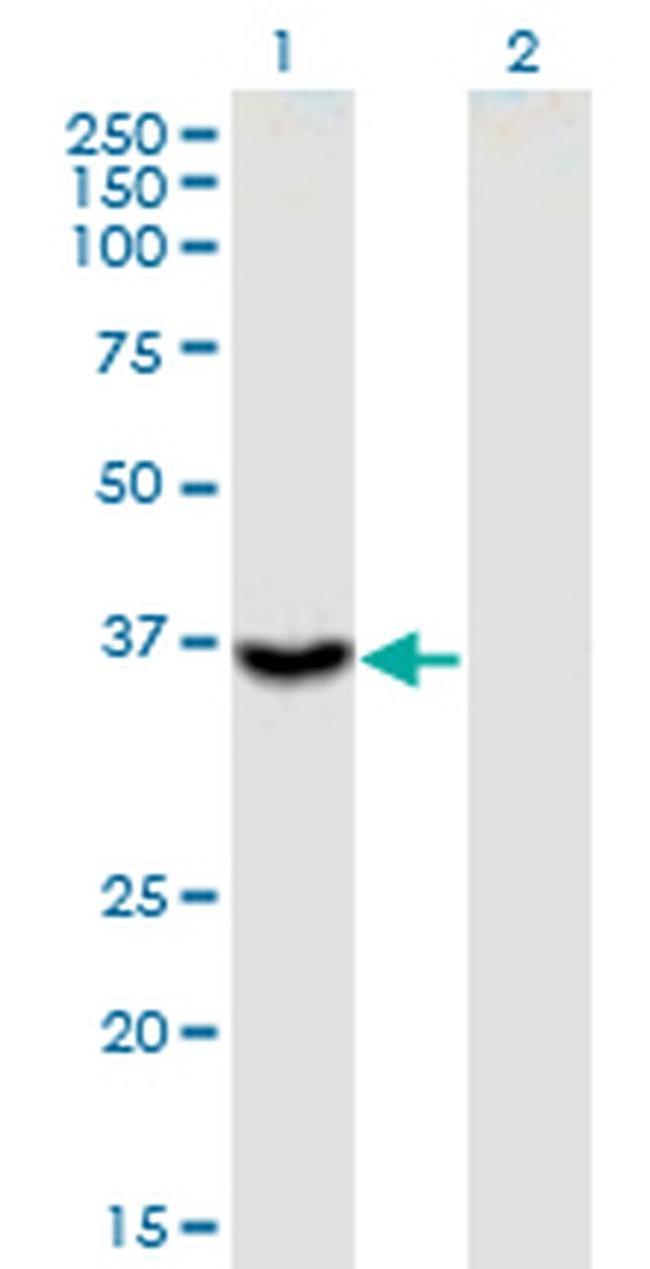 ITGB1BP2 Antibody in Western Blot (WB)