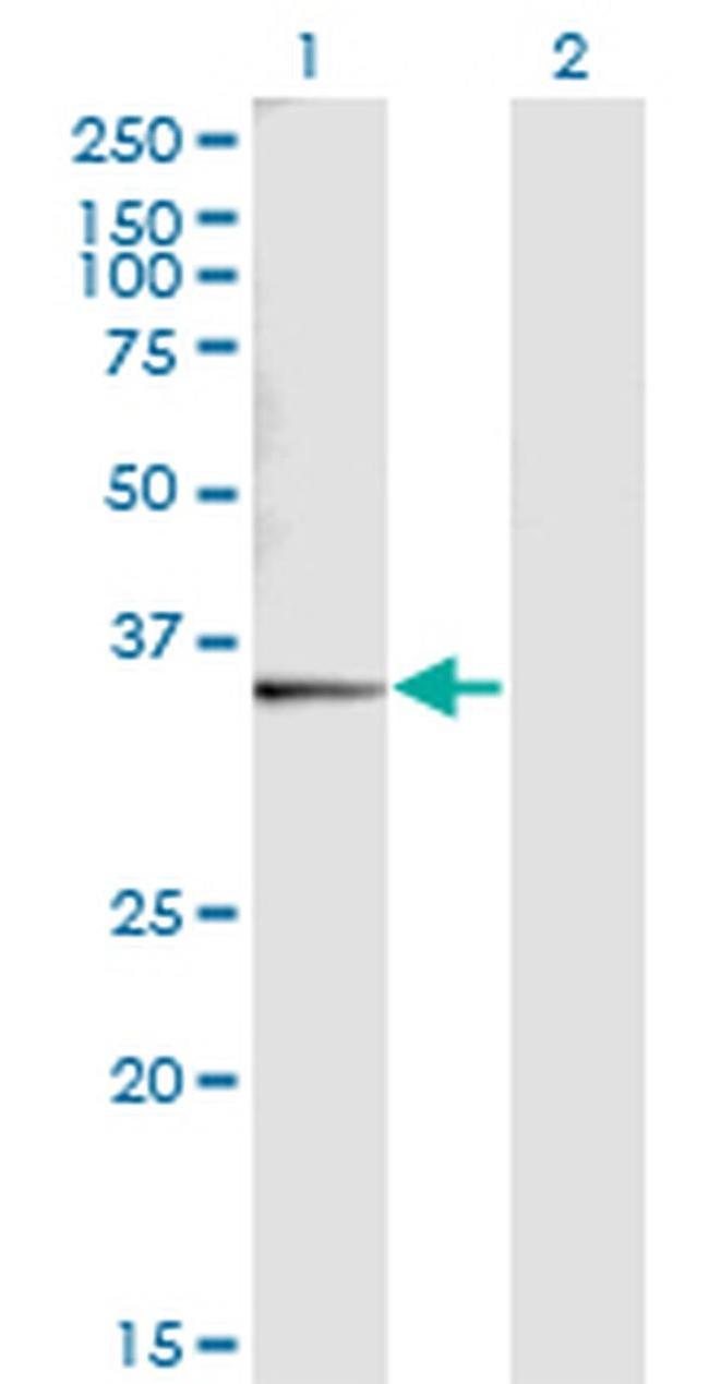 SNX11 Antibody in Western Blot (WB)