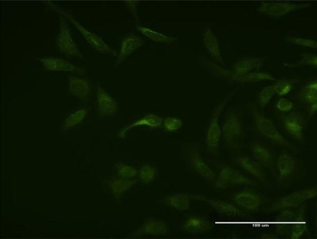 ASB3 Antibody in Immunocytochemistry (ICC/IF)