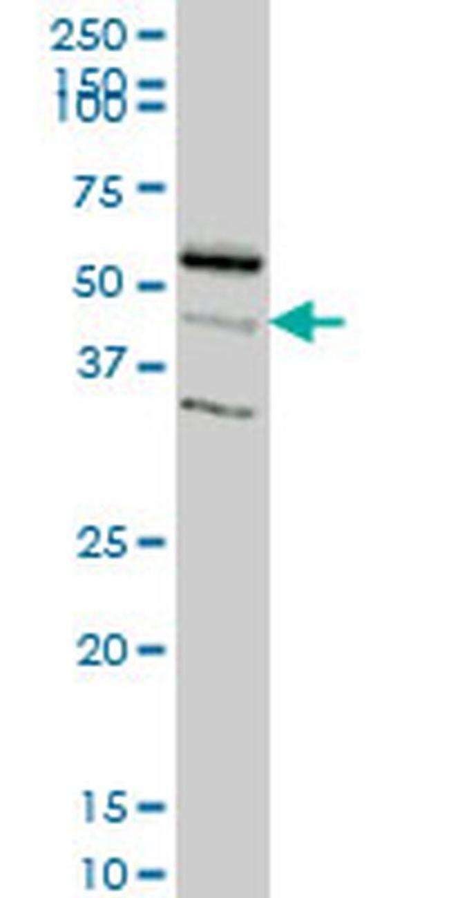 RAPGEFL1 Antibody in Western Blot (WB)