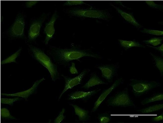 PIPOX Antibody in Immunocytochemistry (ICC/IF)