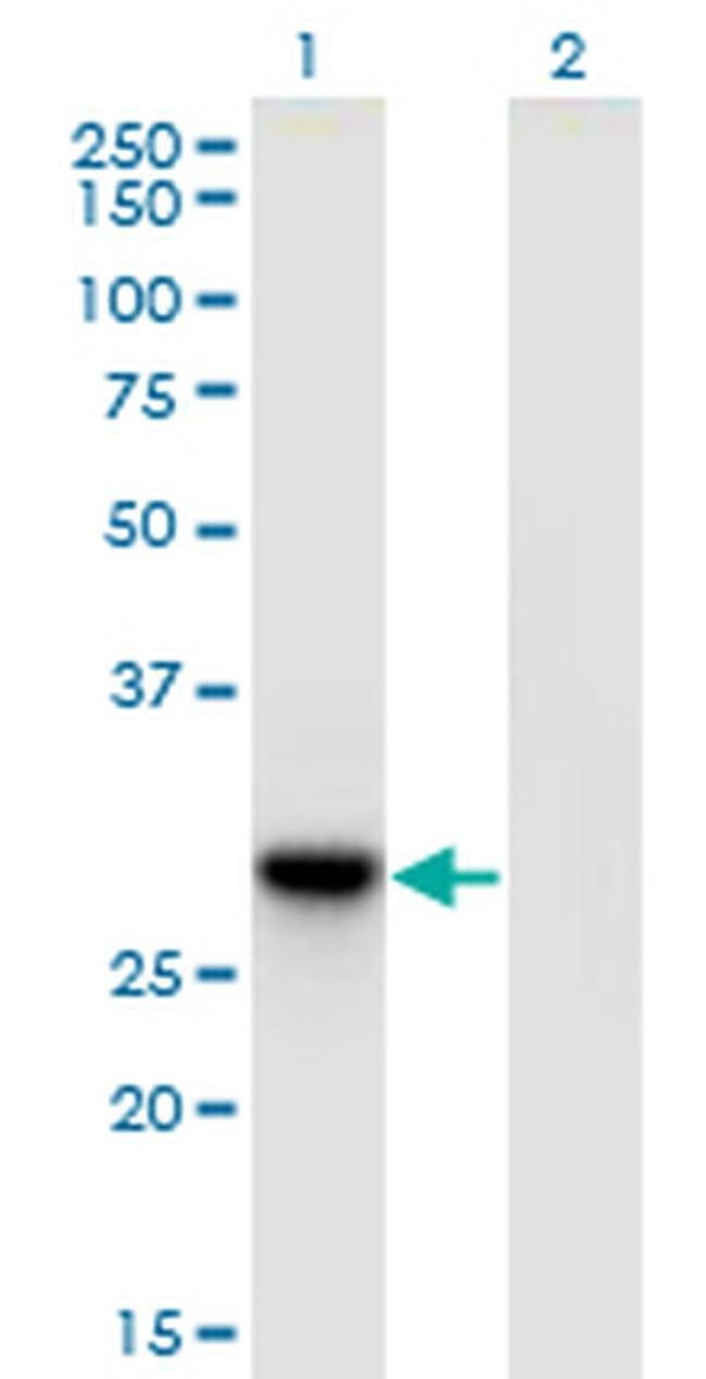 DNAJC27 Antibody in Western Blot (WB)