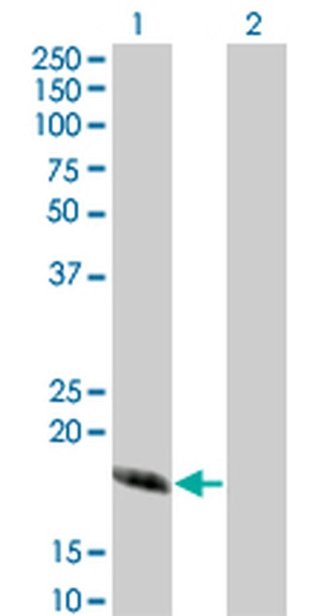 CABP4 Antibody in Western Blot (WB)